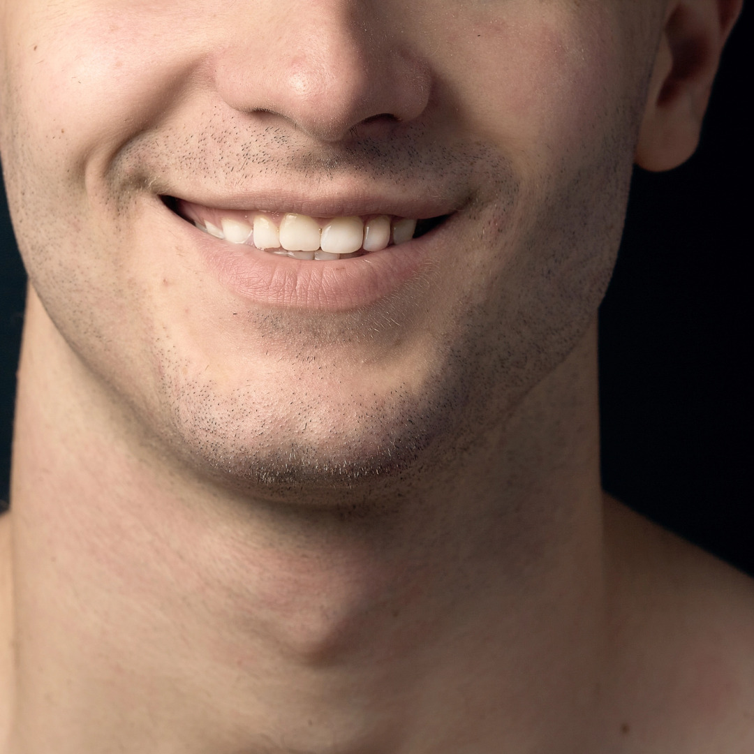 Before image