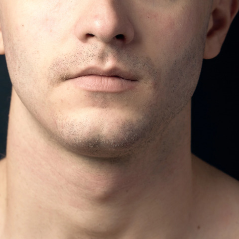 First week — embracing the stubble phase.